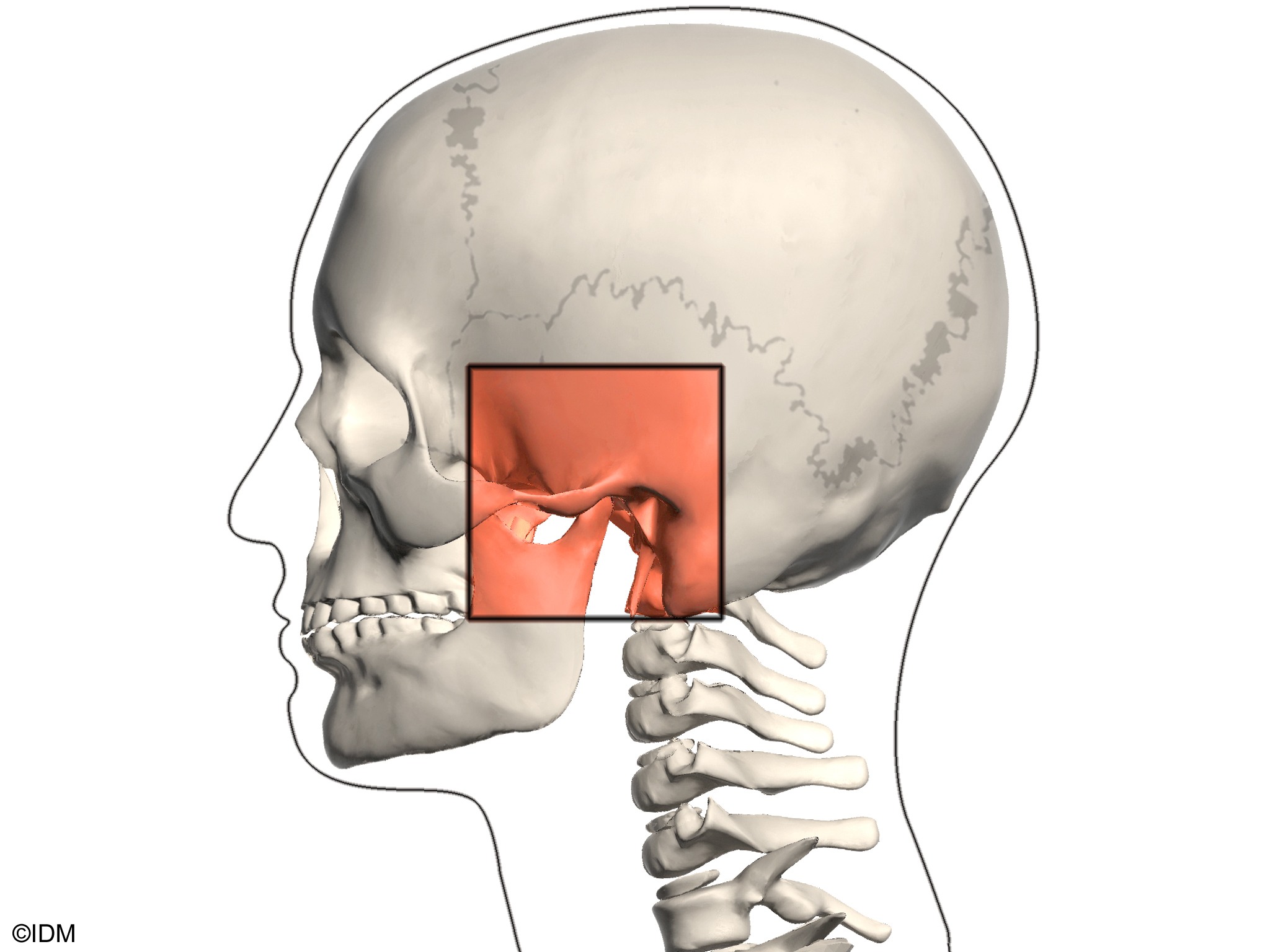 От чего может болеть челюсть. Анкилоз височно-челюстного сустава. Дисфункция челюстного сустава. Челюстно лицевой сустав.